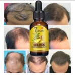 hair growth oil everkey.org
