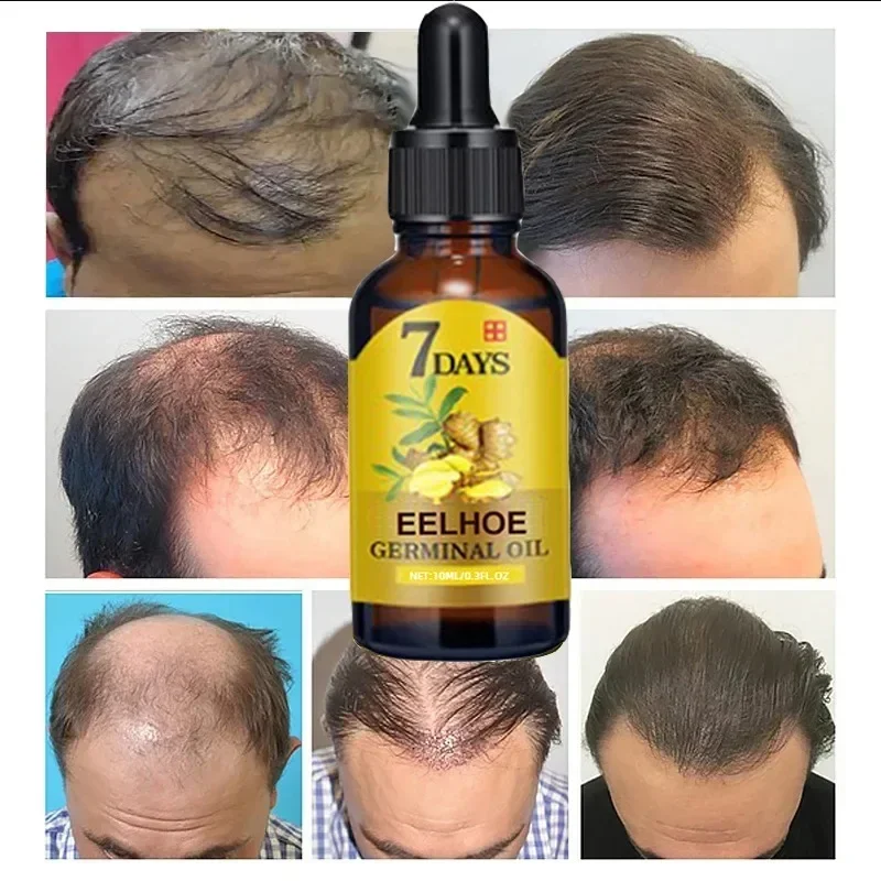 hair growth oil everkey.org